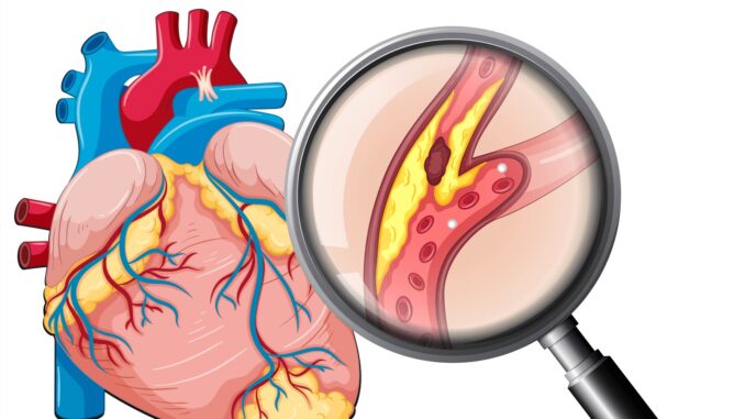 Các bệnh lý về tim mạch thường gặp