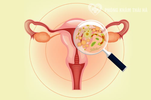 Triệu chứng cảnh báo bệnh lý phụ khoa