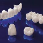 Các loại răng sứ Katana và đặc điểm nổi bật