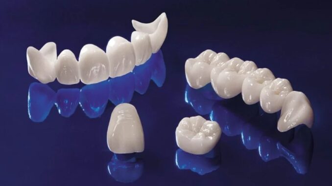 Các loại răng sứ Katana và đặc điểm nổi bật