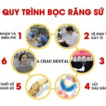 Quy trình bọc răng sứ chuẩn y khoa từng bước chi tiết