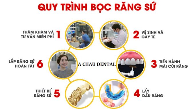 Quy trình bọc răng sứ chuẩn y khoa từng bước chi tiết