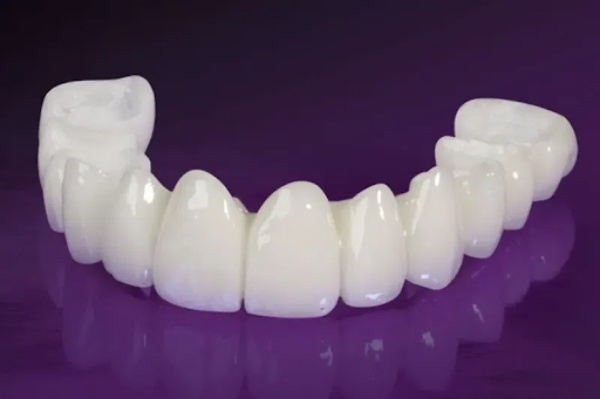 So sánh các loại răng sứ Katana phổ biến