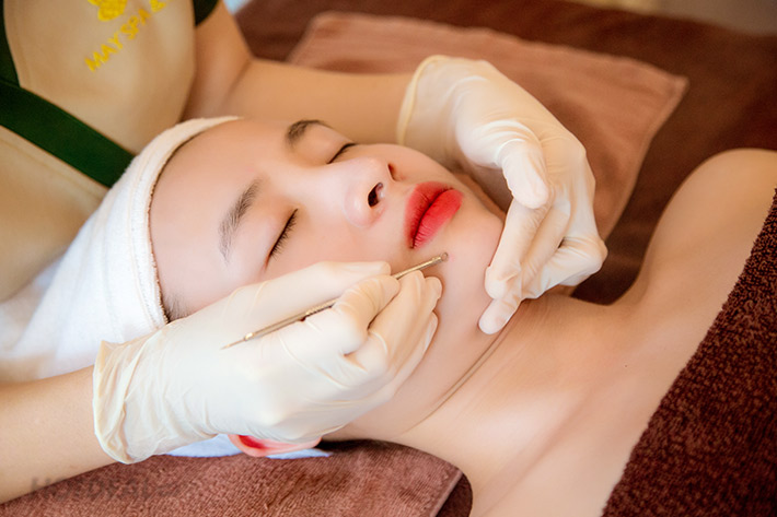 Giải đáp tác động của việc nặn mụn